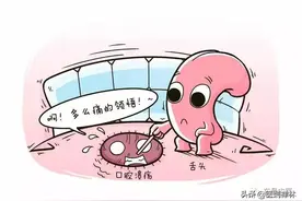 口腔溃疡、舌尖疼痛，并非都是上火了图片