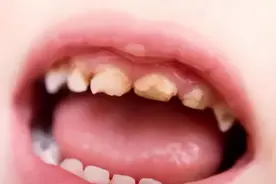 6岁前，这些东西要让孩子尽量少吃！会影响发育图片