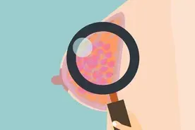 Luminal A、Luminal B、三阴，傻傻分不清楚，细说乳腺癌分子分型图片