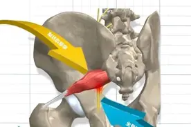 梨状肌综合征图片