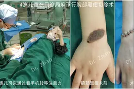 门诊手术的流程及注意事项图片