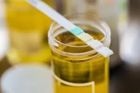 连续几天，尿液都发黄是怎么回事？这几点常见原因，要及时改善图片