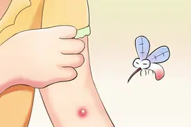 被蚊子叮咬太难受？这样做让瘙痒退退退！图片