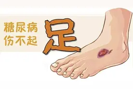 患上糖尿病还会“烂脚”！抓住这些关键点，让你避免截肢图片