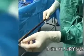 一男子做工时不慎从高空坠落，被一米钢筋从下体穿入，颅顶穿出图片