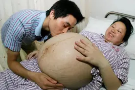 女婴一出生满头白发，家人吓的不敢去抱，医生大骂宝爸“禽兽”图片