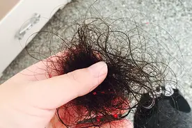 衰老是突然到来的吗？身体有5种表现，说明衰老在加速，一文告知图片