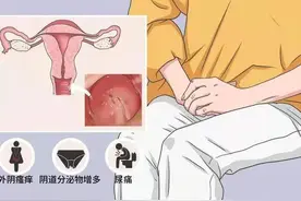 熟悉的维生素E，陌生的用途图片