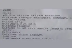 我的小排畸检查经历图片