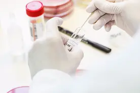 细胞学院 | 干细胞制剂相关检测图片