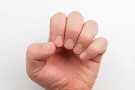 体内有病，手指先知？手指出现2种特征，要排除疾病或癌的可能性图片