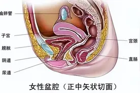 盆腔积液是什么病？很严重吗？图片