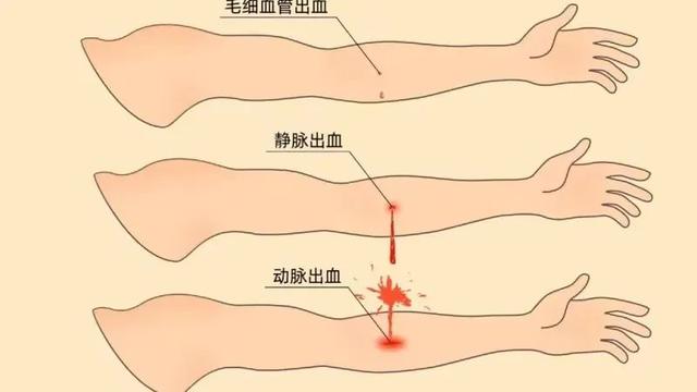 头部外伤应该怎么急救(头部外伤出血的急救)-第2张图片