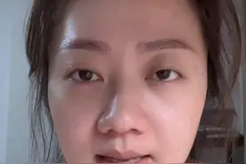 半飞秒术后一个月了，体验感越来越好！ 最后悔的是没有听...图片