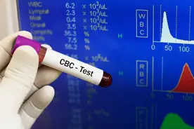 “血常规”能查出癌症吗？医生说出真相，看完后涨知识了图片
