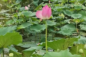 看病记一：血管造影图片