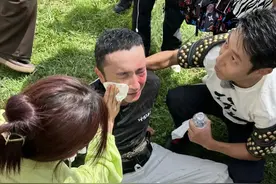 尼格买提录节目摔伤！半张脸红肿跌坐地上，撒贝宁忙搀扶一脸紧张图片