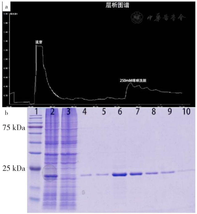 基于量子点标记技术的免疫层析法检测新型冠状病毒N蛋白IgG抗体研究