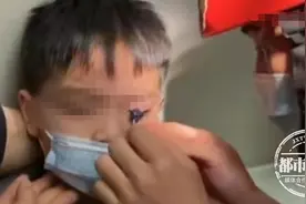 隔着屏幕都疼！拉链死死“咬”住孩子眼皮，消防员紧急出动图片