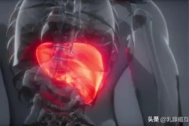 乳腺癌一旦复发转移就无法治愈？三个真相被揭示图片