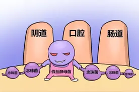 真菌性皮肤病—念珠菌病图片