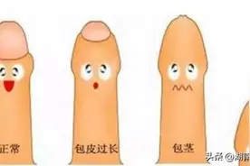 【健康科普】“丁丁”历险记图片