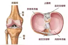 到底什么是半月板损伤？如何改善和预防？这些知识点你要知道图片