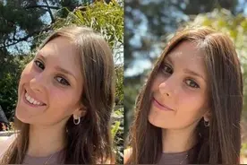 长期戴假发会怎样，网传不仅头皮受损还会加重脱发？真的是这样吗图片
