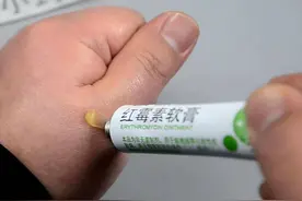 2块钱一支的红霉素软膏，被称之为“淡斑专家”？医生告诉你真相图片
