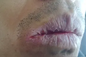 心阴虚舌干、脾阴虚唇干、肾阴虚喉干，三个中成药，帮你缓解干燥图片