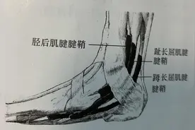 “脚脖痛”之趾长屈肌腱鞘炎图片