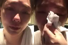 小S牙套日记，这回真的很撩人图片
