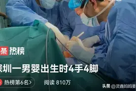 深圳一男婴出生时4手4脚？刚出生要面临做手术，看着很是心疼图片