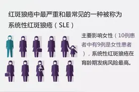 三分钟，带你正确认识红斑狼疮图片