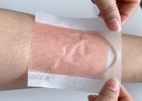 冰点脱毛以后可以擦身体乳吗