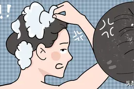 头皮屑太多到底是谁的锅？图片