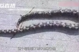 毒蛇钻进被窝咬伤3岁熟睡女童，医生：若不是及时治疗，可能导致脏器衰竭图片