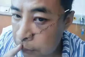 济南“大肠哥”被打，原视频曝光引热议，网友：看到结局放心了图片
