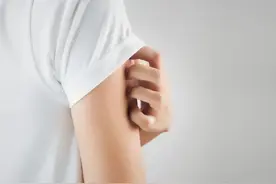 荨麻疹患者指南：9种类型各有特征图片