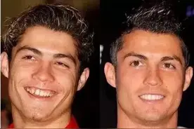 世界杯球星也爱美？内马尔、C罗整容前后判若两人图片