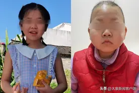 10岁女孩抗癌210天脱相 与病前判若两人图片