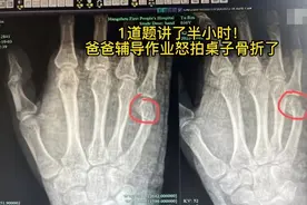 辅导作业被气哭、把手拍骨折，10个妙招，让孩子高质量完成作业图片