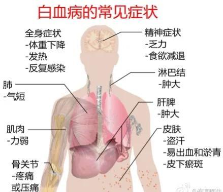 白细胞增多，就是白血病吗？