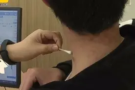 熬夜上瘾！“00后”竟长出老年斑图片