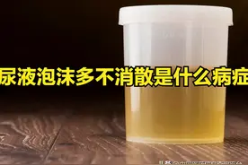 尿液泡沫多不消散是什么病症图片
