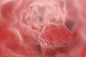 咽喉不适就是咽炎？医生提醒：不要误把食管癌当咽炎图片