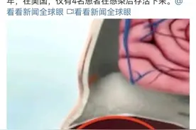美国佛罗里达州自来水受污染，一男子感染“食脑变形虫”死亡。图片