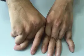 一张风湿方子，赶走寒湿，让你彻底告别风湿、类风湿、关节疼痛图片