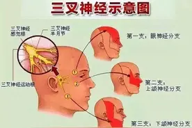 头上长的带状疱疹疼起来最要命，也最容易留后遗症图片
