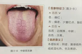 看看中医一些常见的舌诊分析，学到了对自己有很大帮助图片